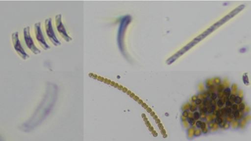 Algae Identification (AlgaEye) cell counting1