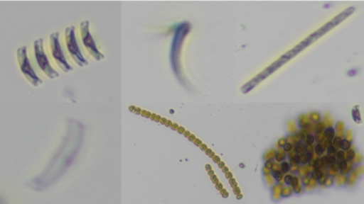Algae Cell Counting